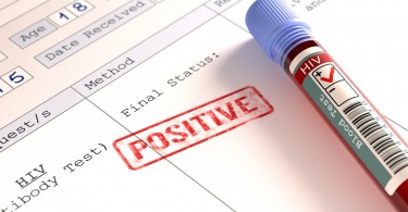 Hiv